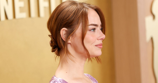 Borítókép: „Ez már nem Emma Stone?” - egyetlen fotó miatt ismét beindultak a találgatások a színésznő külsejéről